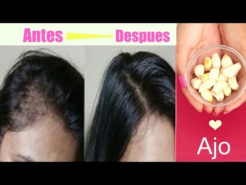 Opiniones y beneficios del uso de ajo para el cabello